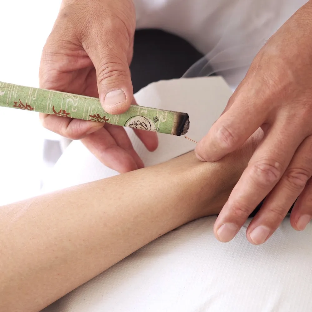 Tratamiento de acupuntura con calor